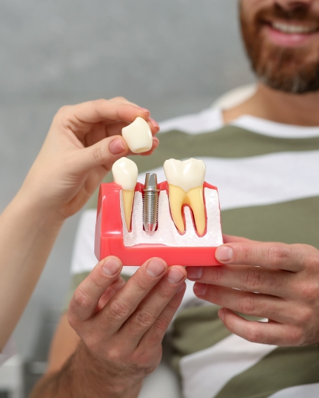 Dentist placing a crown over a dental implant model in front of a patient