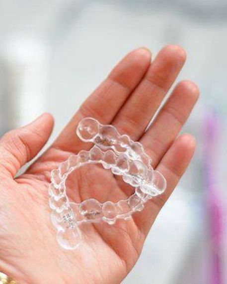 Hand holding two Invisalign aligners