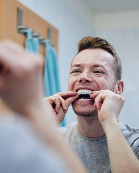 Man in front of mirror placing whitening tray over his teeth