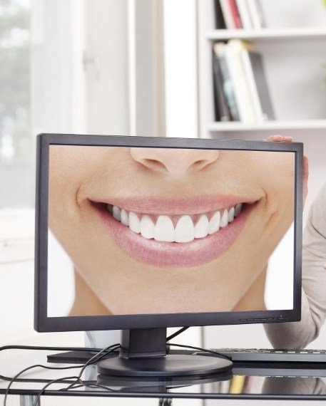 Computer monitor showing close up of flawless smile