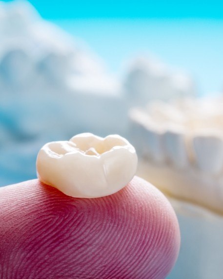 Dental crown resting on a finger