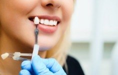 Dentist holding shade guide to a patients tooth