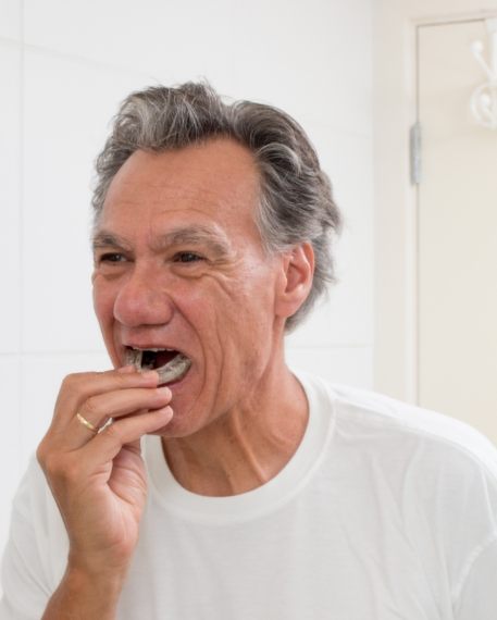 Man placing a nightguard over his teeth