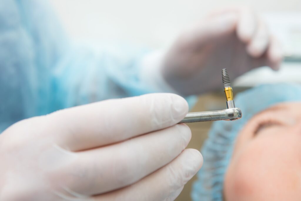 Closeup of dentist holding implant with patient in background