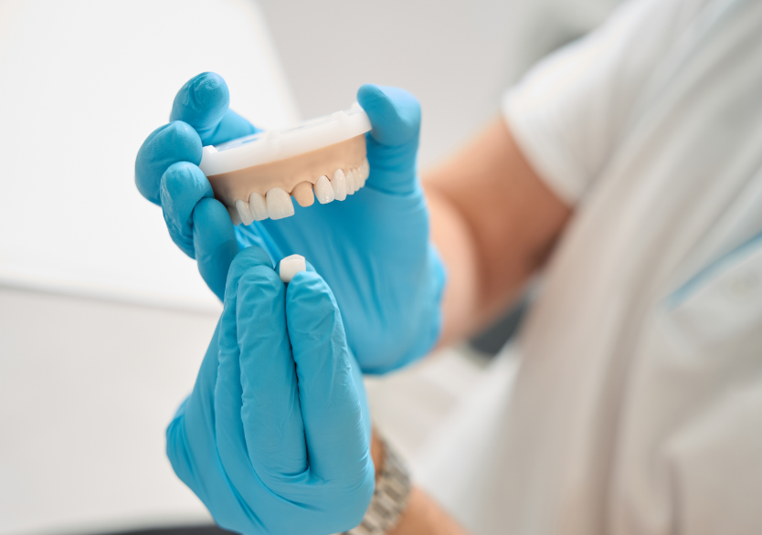 Dentist holding model of a dental crown